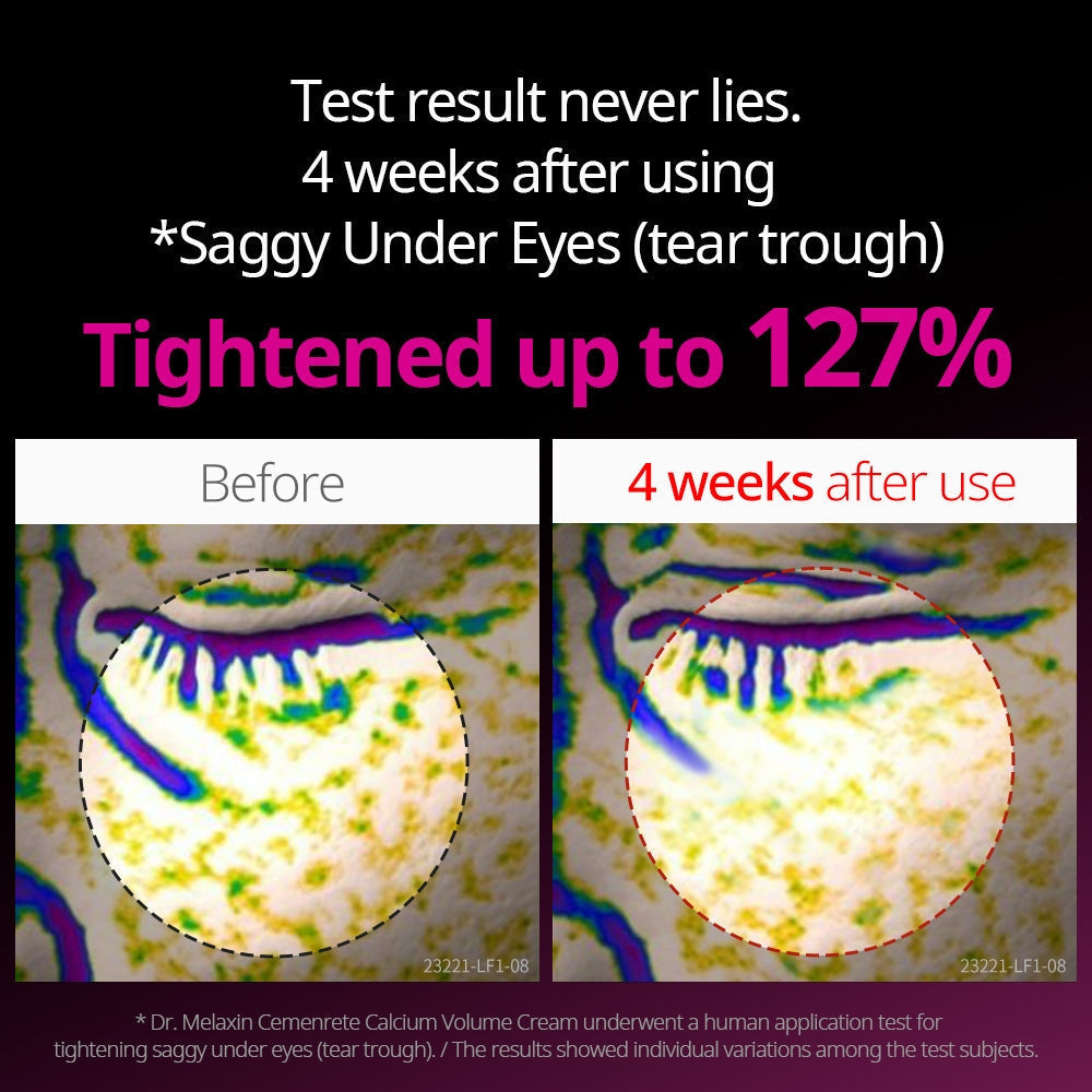 Dr.Melaxin Cemenrete Calcium Intense Cream