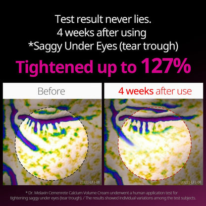 Dr.Melaxin Cemenrete Calcium Intense Cream